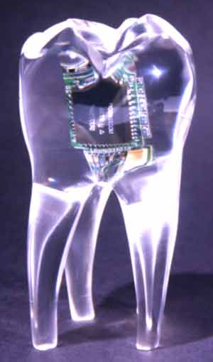 радио зуб - имплантант